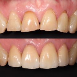 Negocio Dentists In Brickell - Hq Dontics Dental Centre
