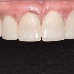 Negocio Miracle Smile Dentistry - Dr. Anna Aller