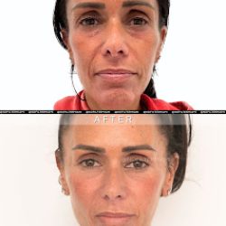 Negocio No Filter Medical Spa