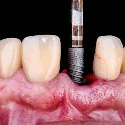 Negocio Perfect Smile Dental Centers - Dadeland