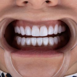 Negocio Smile Design Miami