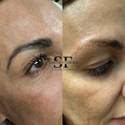 Negocio South Florida Laser Studio Midtown Miami